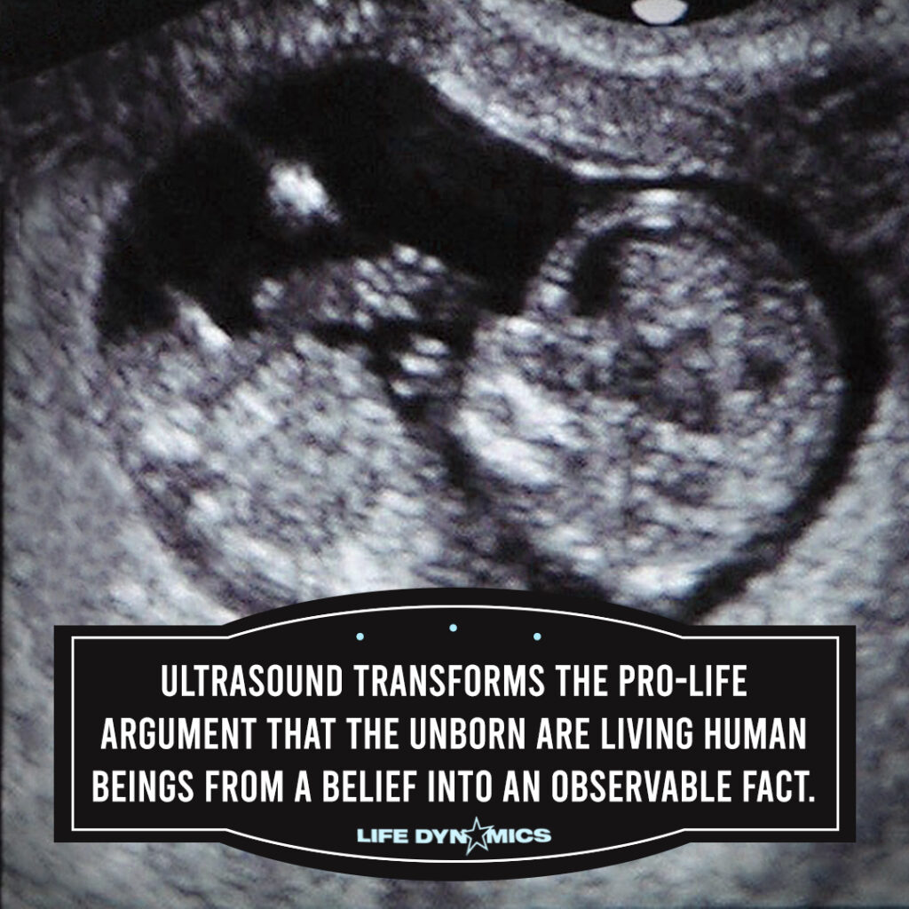 Ultrasound transforms the pro-life argument that the unborn are living human beings from a belief into an observable fact.