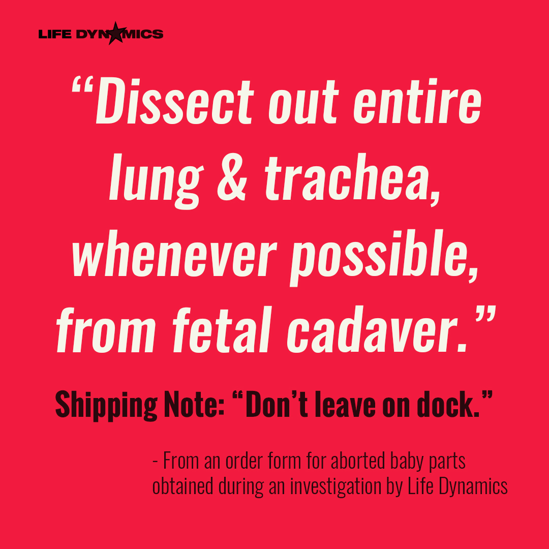 "Dissect out entire lung & trachea, whenever possible, from fetal cadaver." Shipping Note: "Don't leave on dock." - From an order from for aborted baby parts obtained during an investigation by Life Dynamics.