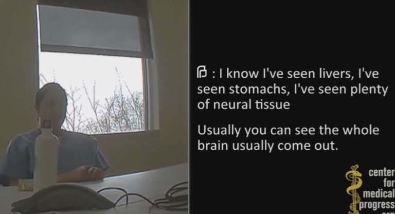 Cracks of baby skull heard in Planned Parenthood vid where doc says babies are sometimes delivered before abortion