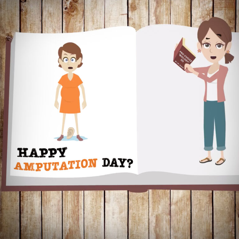 #72 – Happy Amputation Day?!